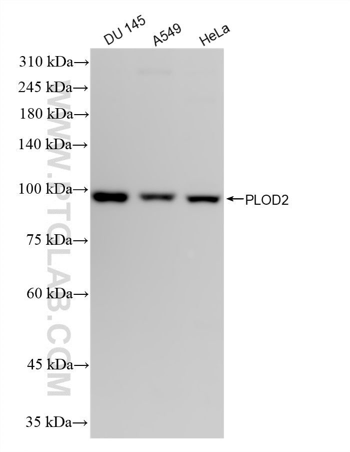 WB analysis using 88222-2-RR Western Blot (WB) analysis of various lysates using PLOD2 Recombinant monoclonal antibody (88222-2-RR)