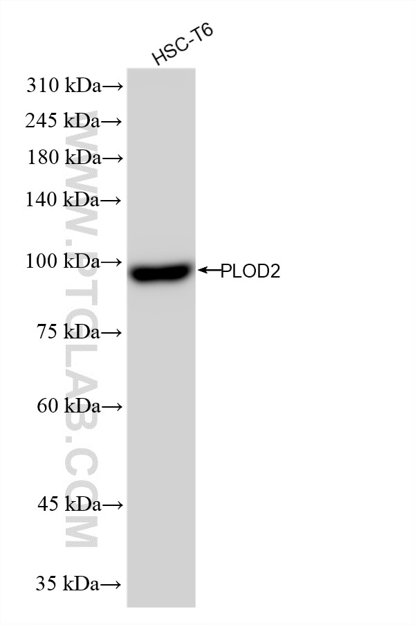 WB analysis using 88222-2-RR Western Blot (WB) analysis of various lysates using PLOD2 Recombinant monoclonal antibody (88222-2-RR)