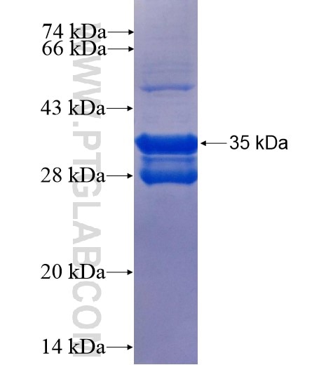 PLOD2 fusion protein Ag15614 SDS-PAGE