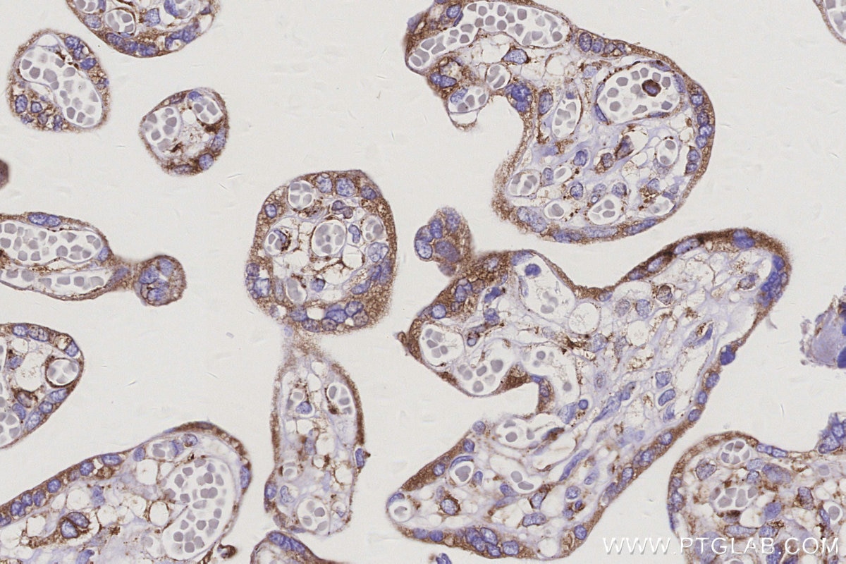 Immunohistochemistry (IHC) staining of human placenta tissue using PLOD3 Polyclonal antibody (11027-1-AP)