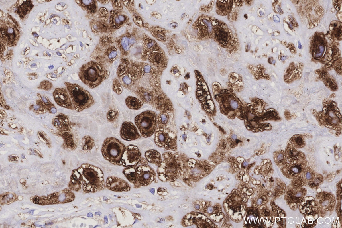 Immunohistochemistry (IHC) staining of human placenta tissue using PLOD3 Polyclonal antibody (11027-1-AP)