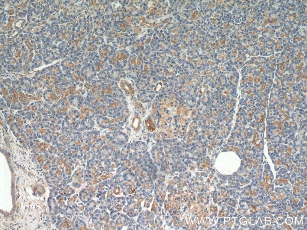 IHC staining of human pancreas using 11027-1-AP