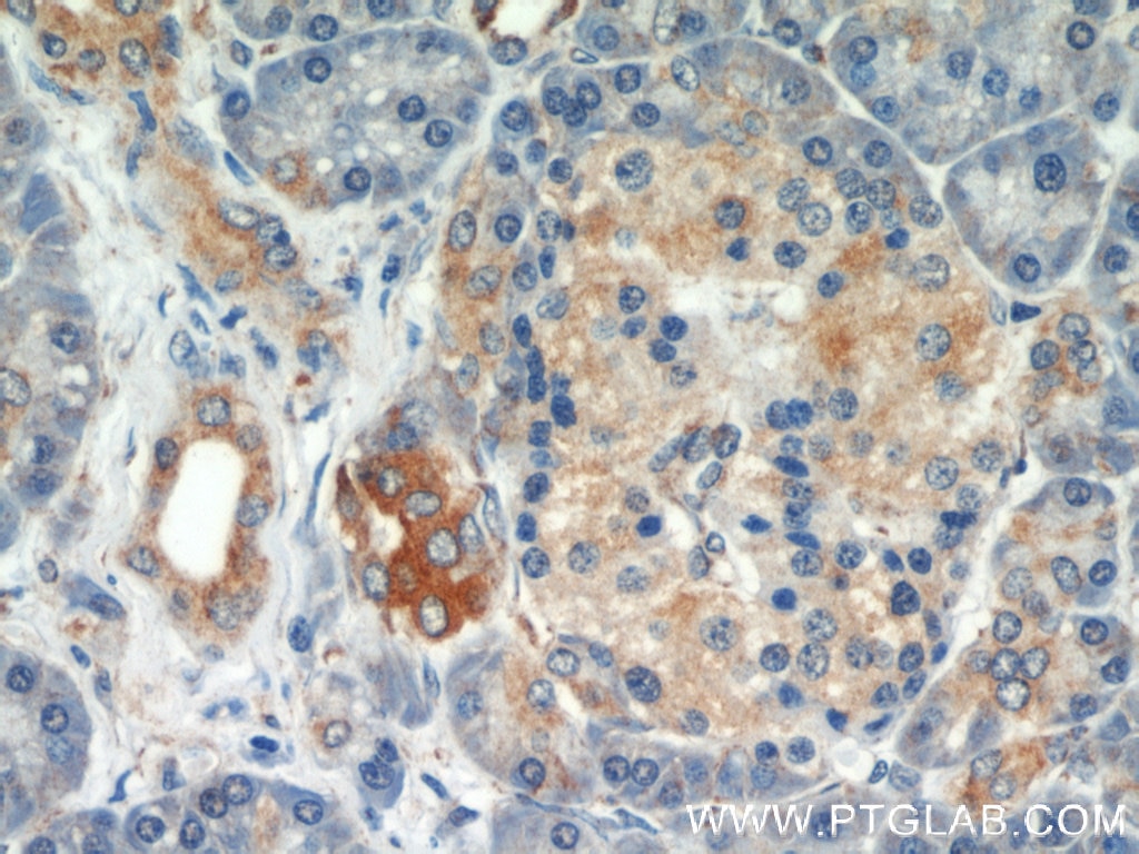 Immunohistochemistry (IHC) staining of human pancreas tissue using PLOD3 Polyclonal antibody (11027-1-AP)