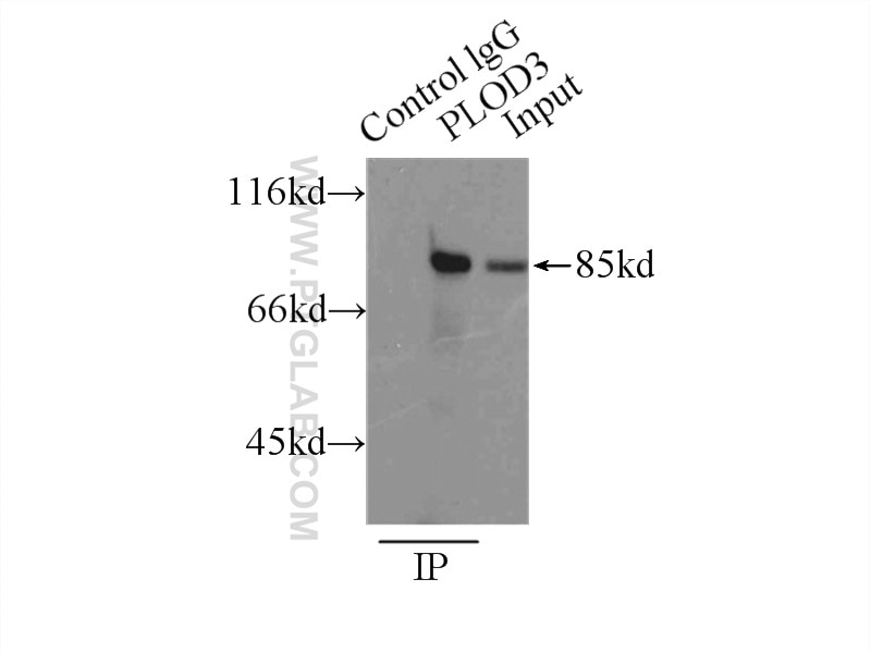 IP experiment of HepG2 using 11027-1-AP