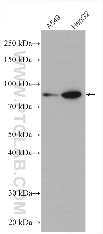 Western Blot (WB) analysis of various lysates using PLOD3 Polyclonal antibody (11027-1-AP)