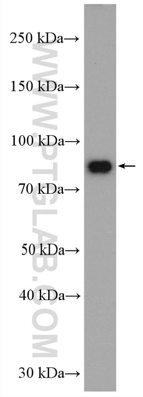 Western Blot (WB) analysis of A549 cells using PLOD3 Polyclonal antibody (11027-1-AP)