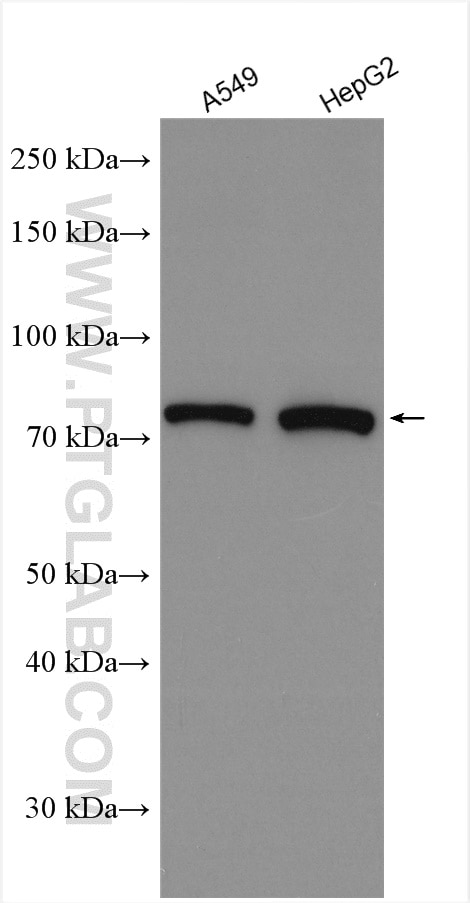 Western Blot (WB) analysis of various lysates using PLOD3 Polyclonal antibody (11027-1-AP)
