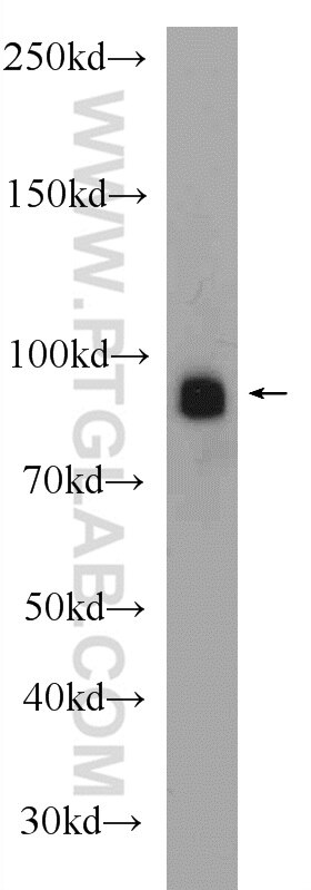 Western Blot (WB) analysis of mouse placenta tissue using PLOD3 Polyclonal antibody (11027-1-AP)