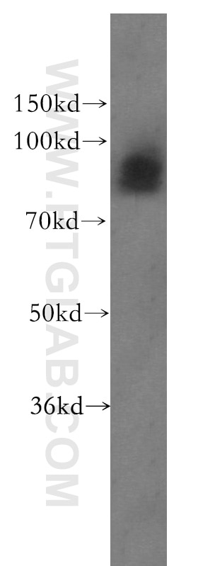 Western Blot (WB) analysis of PC-3 cells using PLOD3 Polyclonal antibody (11027-1-AP)