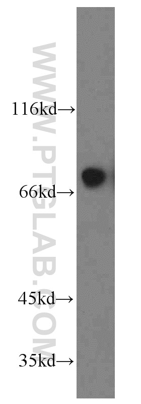 Western Blot (WB) analysis of human placenta tissue using PLOD3 Polyclonal antibody (11027-1-AP)