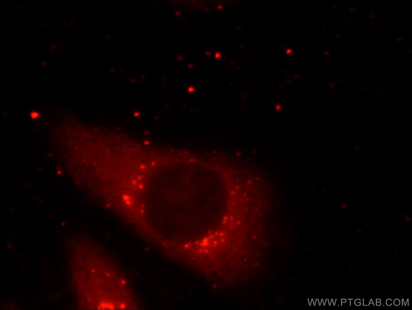 Immunofluorescence (IF) / fluorescent staining of HeLa cells using PLOD3 Monoclonal antibody (60058-1-Ig)