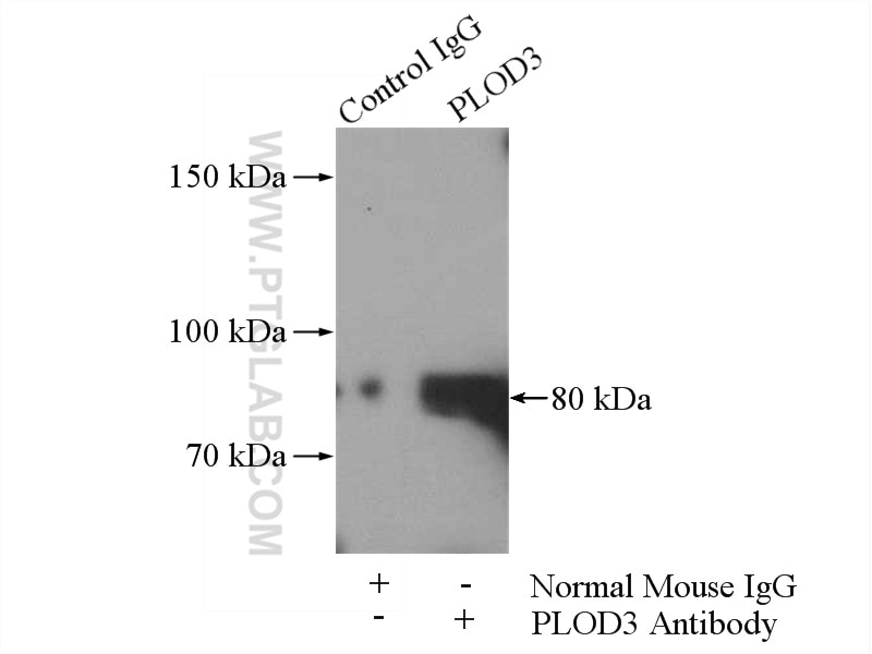 Immunoprecipitation (IP) experiment of HeLa cells using PLOD3 Monoclonal antibody (60058-1-Ig)