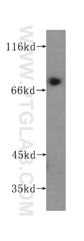 Western Blot (WB) analysis of human placenta tissue using PLOD3 Monoclonal antibody (60058-1-Ig)