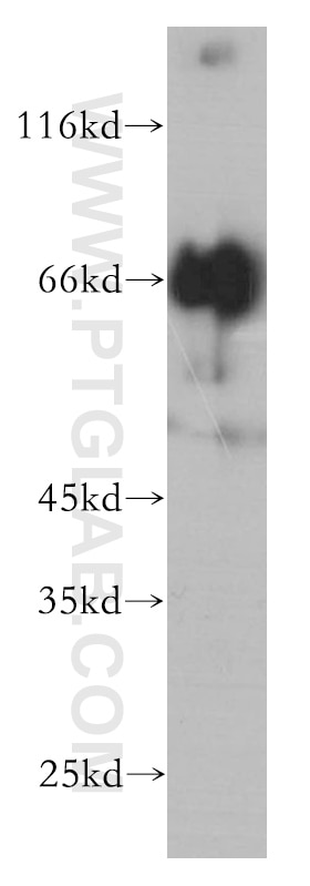 Western Blot (WB) analysis of PC-3 cells using PLOD3 Monoclonal antibody (60058-1-Ig)