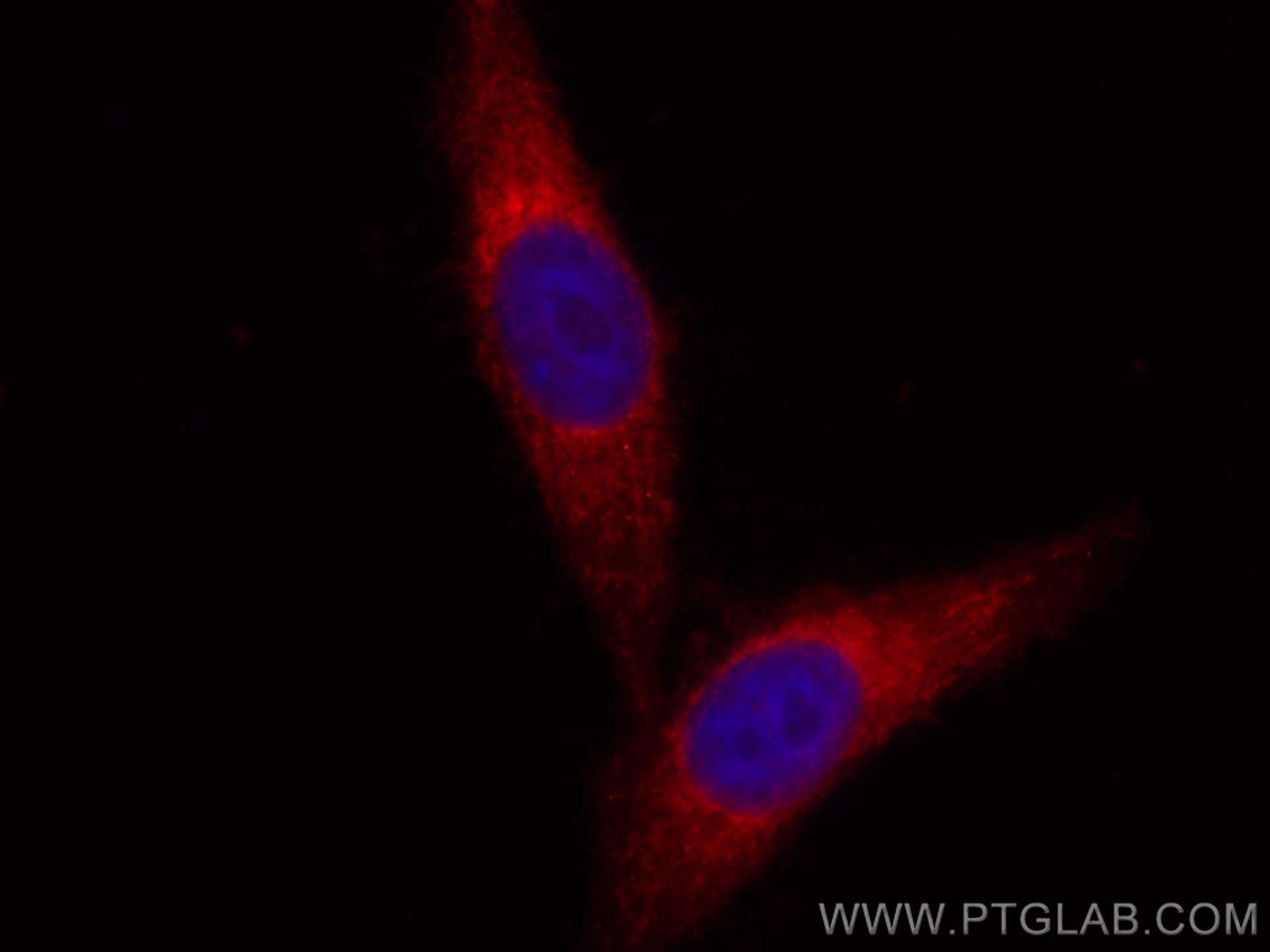 Immunofluorescence (IF) / fluorescent staining of HepG2 cells using CoraLite®594-conjugated PLOD3 Polyclonal antibody (CL594-11027)