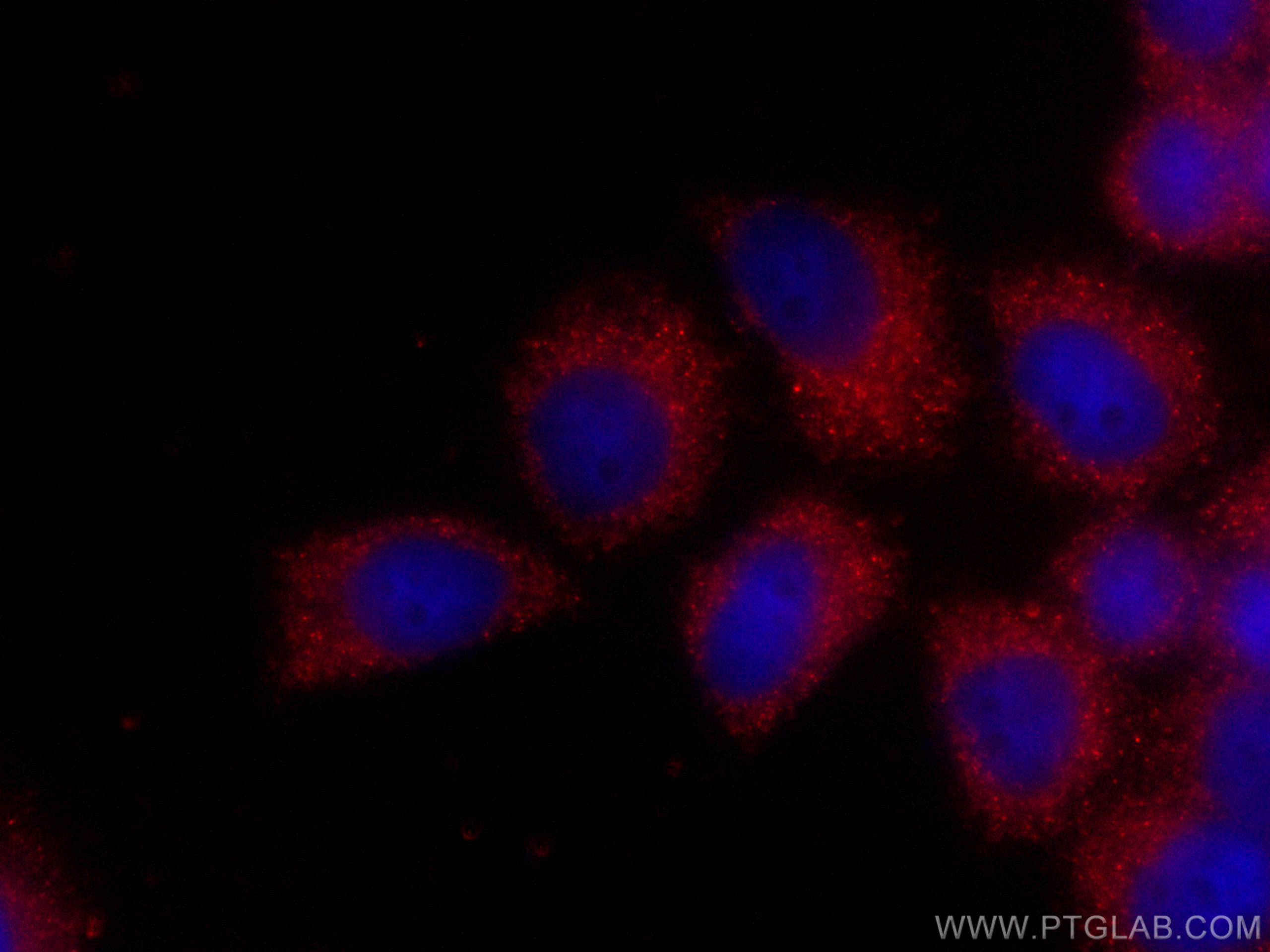 Immunofluorescence (IF) / fluorescent staining of HeLa cells using CoraLite®594-conjugated PLOD3 Monoclonal antibody (CL594-60058)