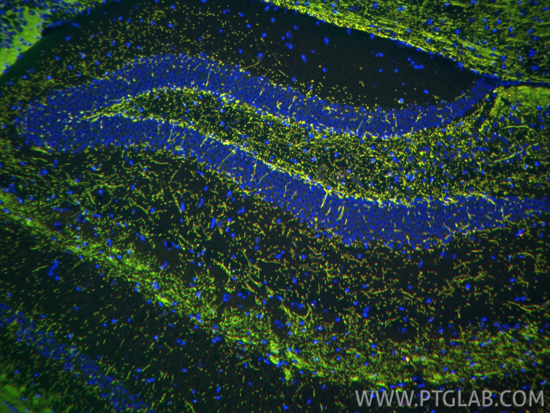 IF Staining of mouse brain using 33901-1-AP Immunofluorescence (IF) / fluorescent staining of mouse brain tissue using PLP1 Polyclonal antibody (33901-1-AP)