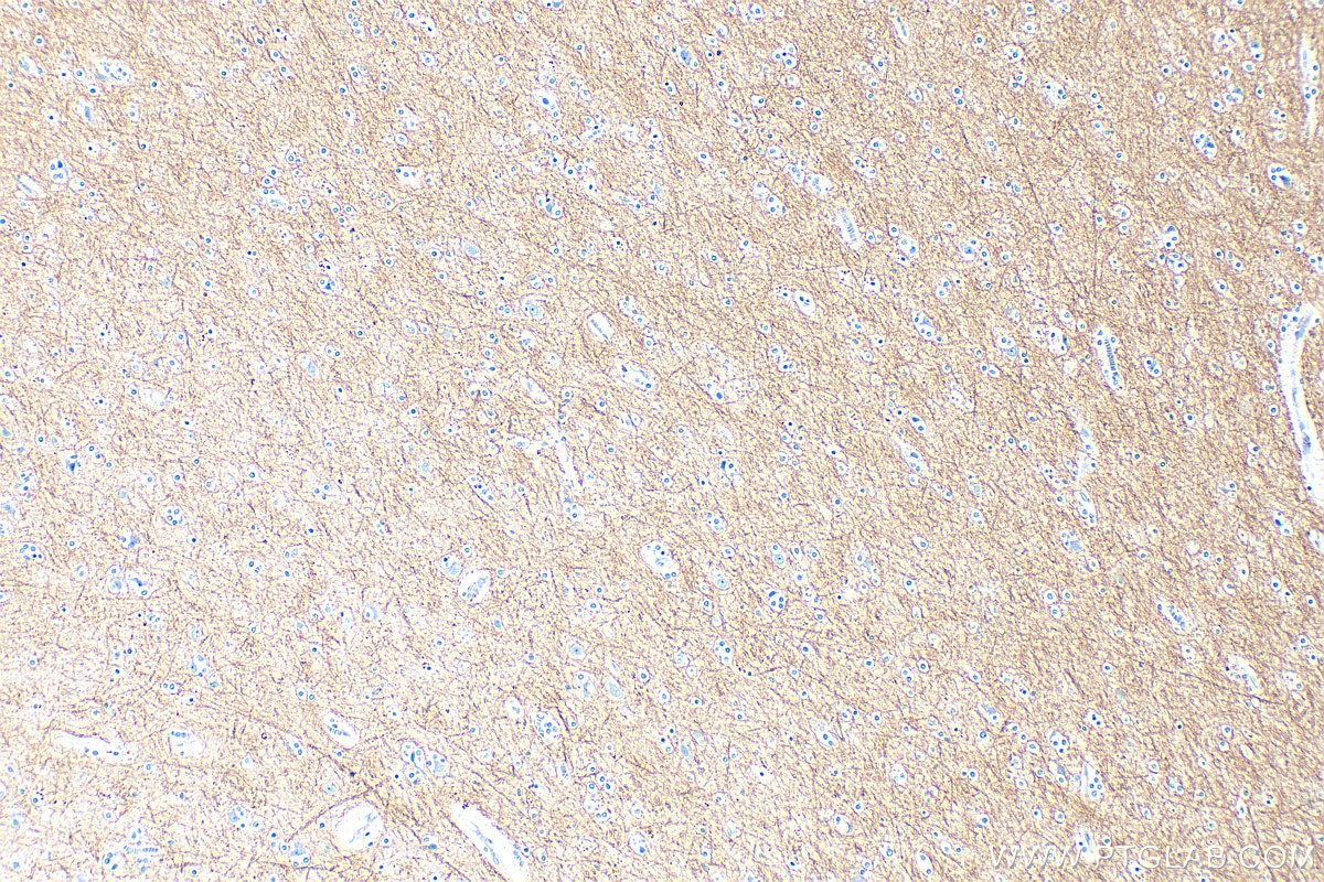 IHC staining of human brain using 33901-1-AP Immunohistochemistry (IHC) staining of human brain tissue using PLP1 Polyclonal antibody (33901-1-AP)