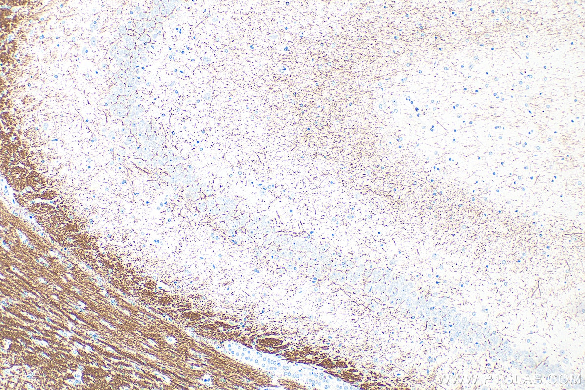 IHC staining of rat brain using 33901-1-AP Immunohistochemistry (IHC) staining of rat brain tissue using PLP1 Polyclonal antibody (33901-1-AP)