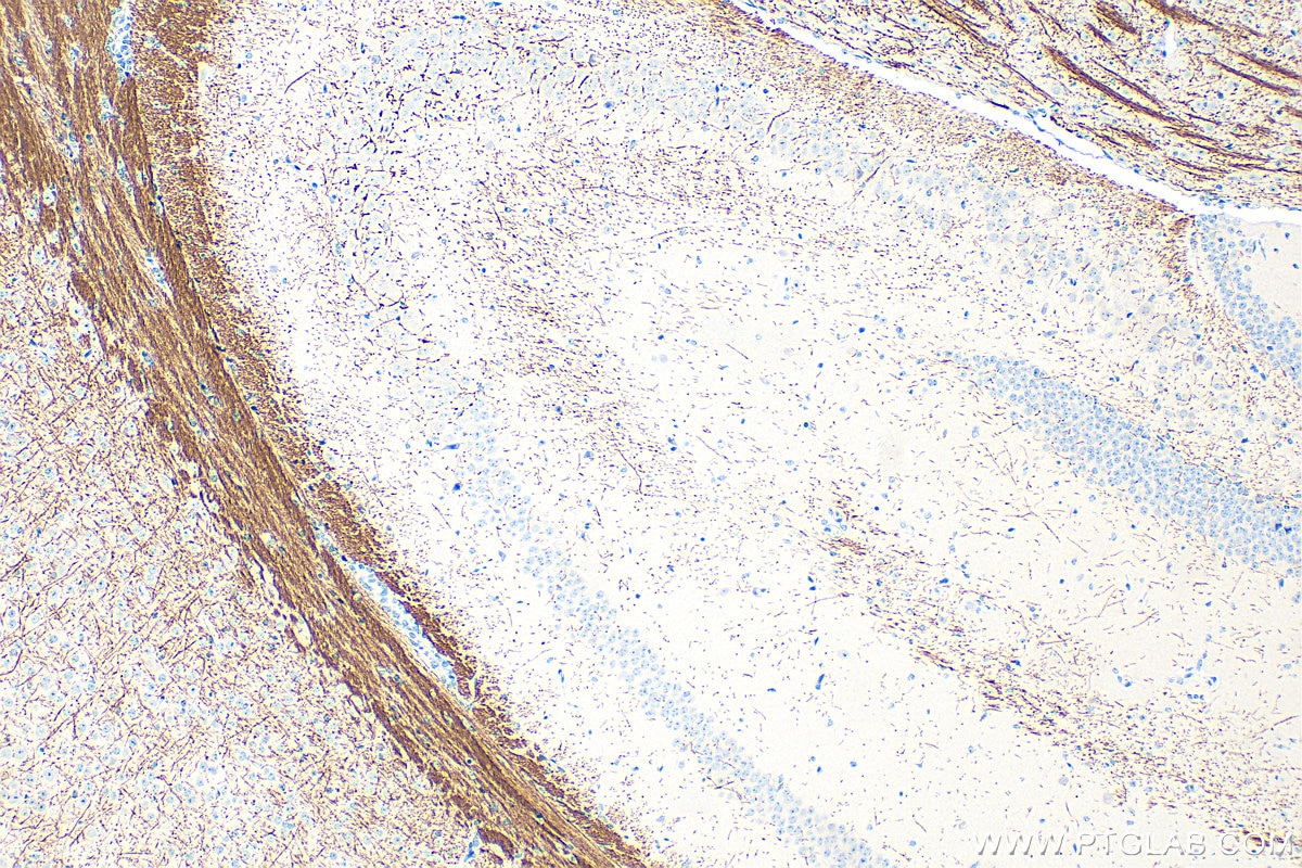 IHC staining of mouse brain using 33901-1-AP Immunohistochemistry (IHC) staining of mouse brain tissue using PLP1 Polyclonal antibody (33901-1-AP)