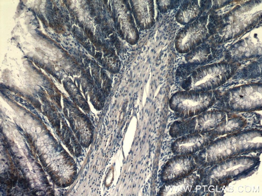 Immunohistochemistry (IHC) staining of human colon tissue using PLP2 Polyclonal antibody (21482-1-AP)