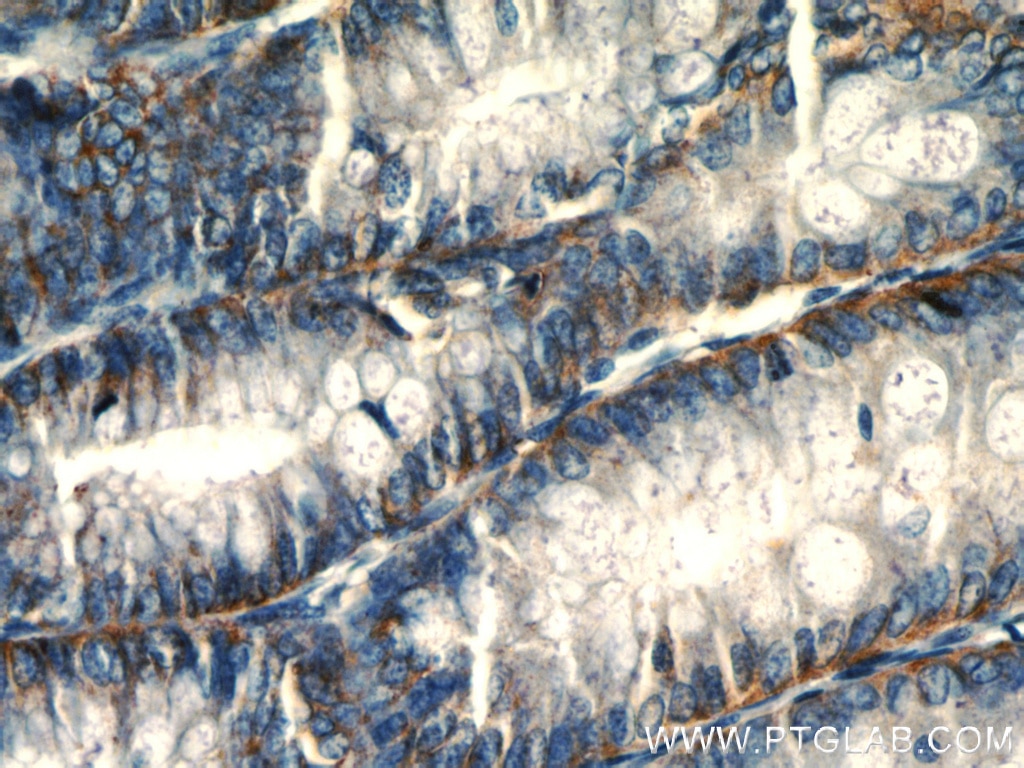 Immunohistochemistry (IHC) staining of human colon tissue using PLP2 Polyclonal antibody (21482-1-AP)