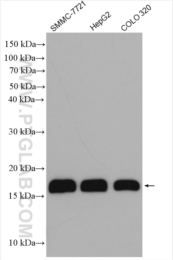 Western Blot (WB) analysis of various lysates using PLP2 Polyclonal antibody (21482-1-AP)