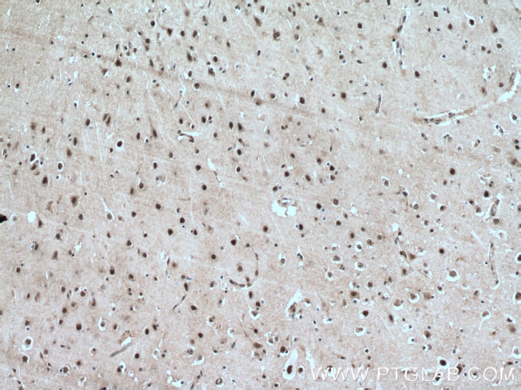 IHC staining of human brain using 11914-1-AP