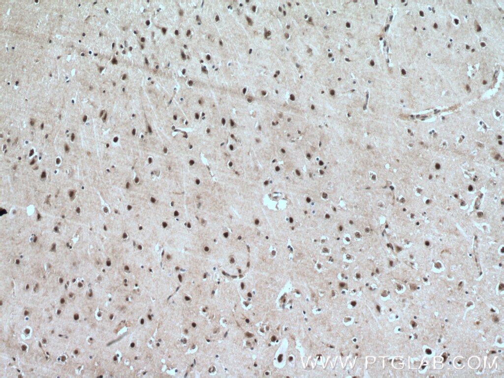 Immunohistochemistry (IHC) staining of human brain tissue using PLRG1 Polyclonal antibody (11914-1-AP)