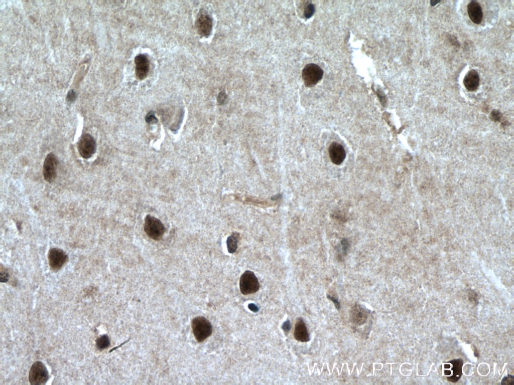 Immunohistochemistry (IHC) staining of human brain tissue using PLRG1 Polyclonal antibody (11914-1-AP)