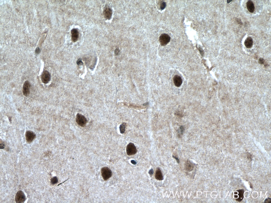 IHC staining of human brain using 11914-1-AP