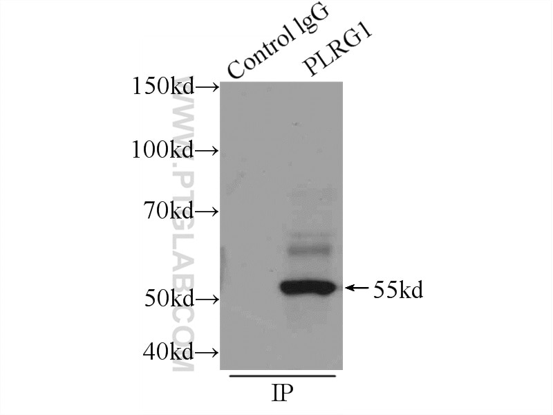 Immunoprecipitation (IP) experiment of HEK-293 cells using PLRG1 Polyclonal antibody (11914-1-AP)