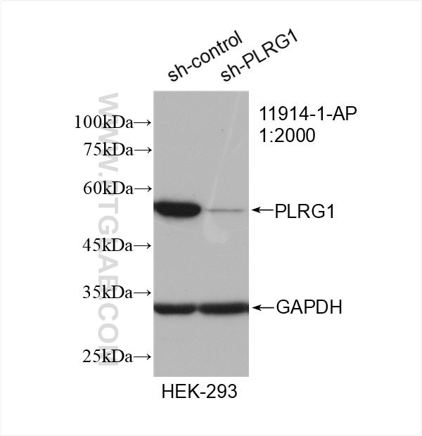 Western Blot (WB) analysis of HEK-293 cells using PLRG1 Polyclonal antibody (11914-1-AP)