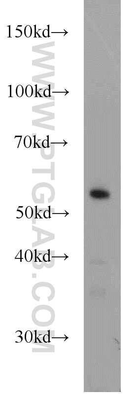 Western Blot (WB) analysis of HEK-293 cells using PLRG1 Polyclonal antibody (11914-1-AP)