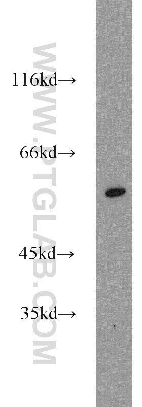 Western Blot (WB) analysis of BxPC-3 cells using PLRG1 Polyclonal antibody (11914-1-AP)