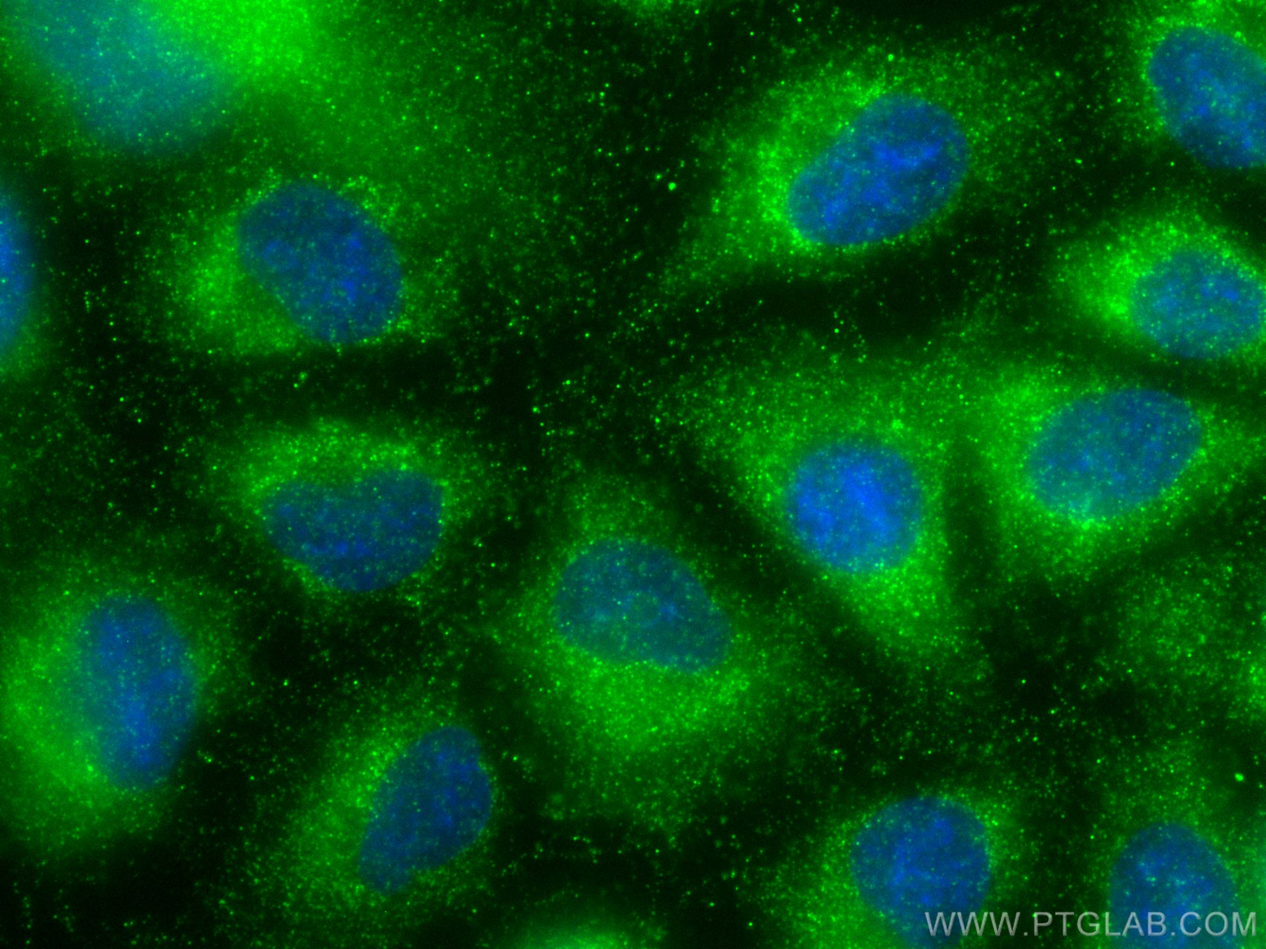 Immunofluorescence (IF) / fluorescent staining of A549 cells using PLS1 Polyclonal antibody (13143-1-AP)