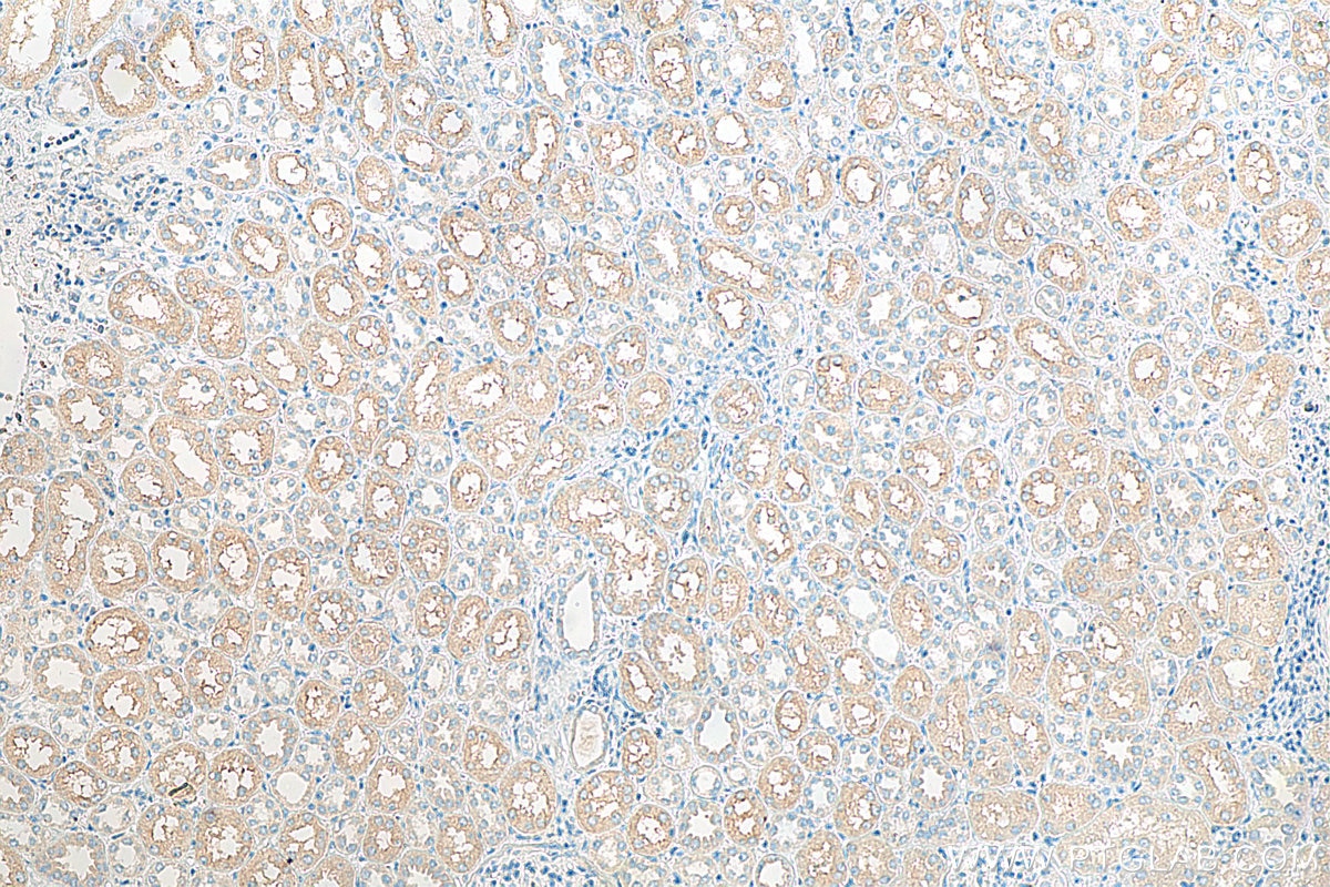 Immunohistochemistry (IHC) staining of human kidney tissue using PLS1 Polyclonal antibody (13143-1-AP)