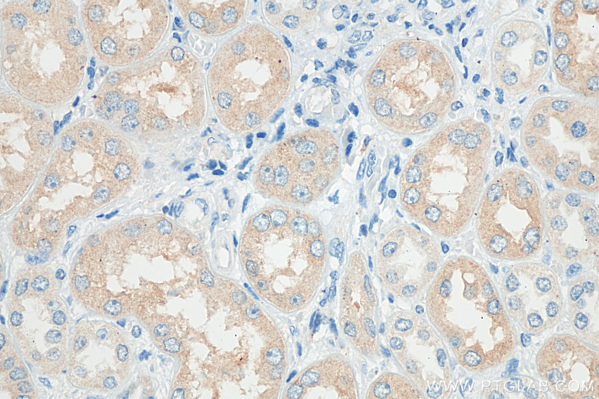 Immunohistochemistry (IHC) staining of human kidney tissue using PLS1 Polyclonal antibody (13143-1-AP)