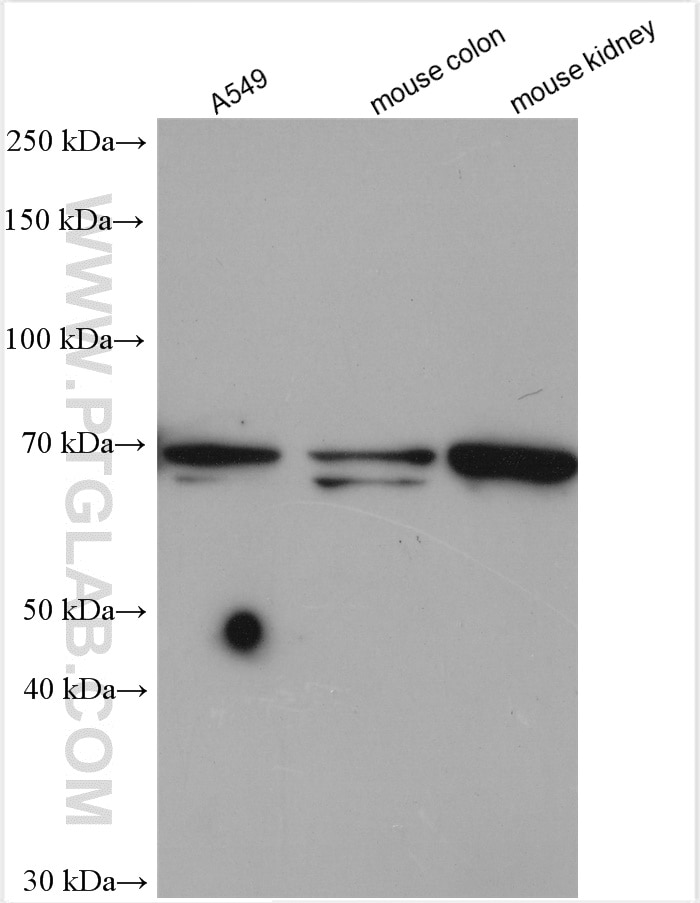 Western Blot (WB) analysis of various lysates using PLS1 Polyclonal antibody (13143-1-AP)