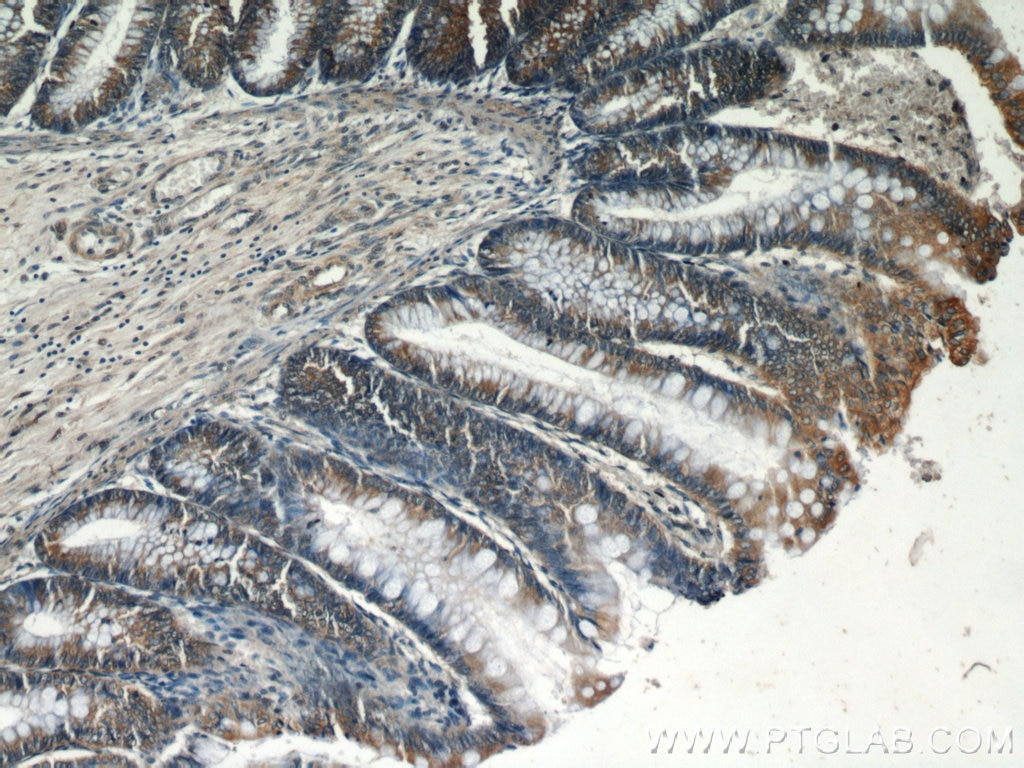 IHC staining of human colon using 55212-1-AP