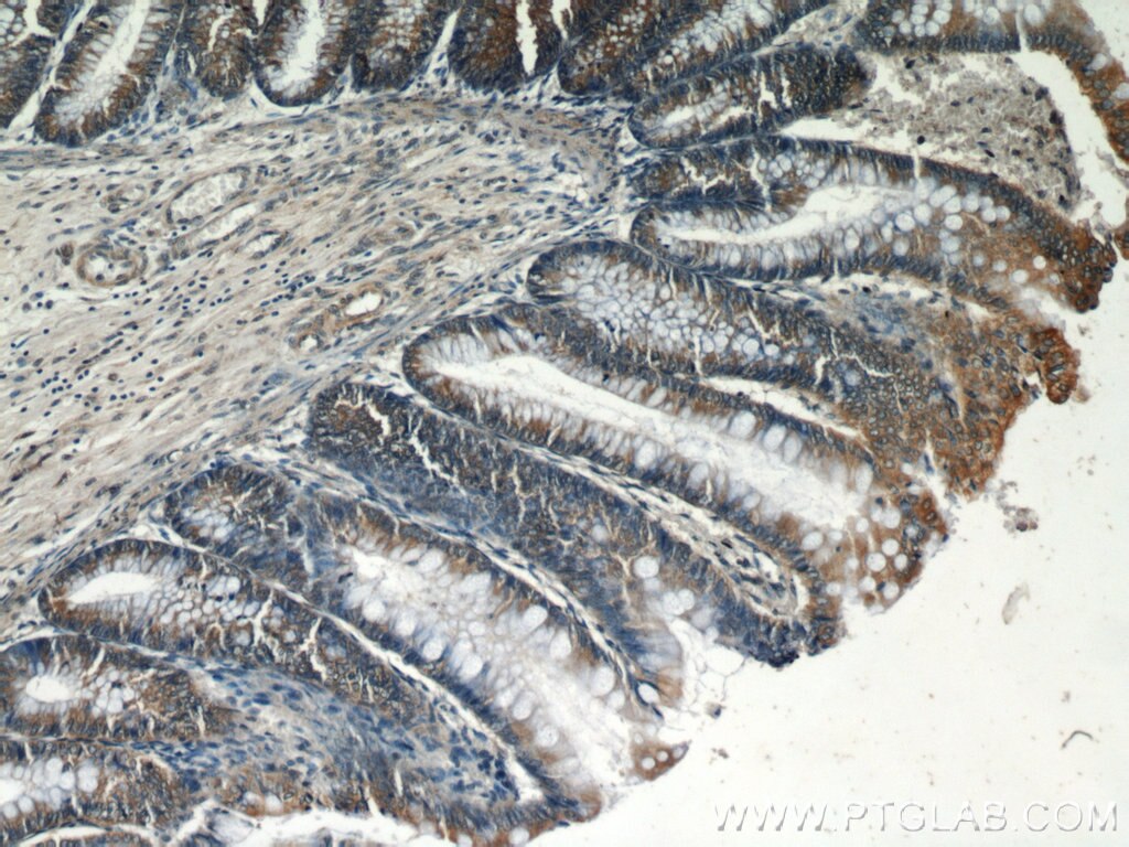 Immunohistochemistry (IHC) staining of human colon tissue using PLS1 Polyclonal antibody (55212-1-AP)