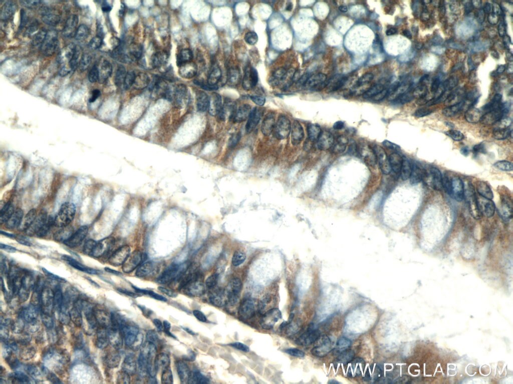 Immunohistochemistry (IHC) staining of human colon tissue using PLS1 Polyclonal antibody (55212-1-AP)