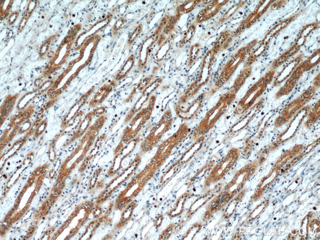Immunohistochemistry (IHC) staining of human kidney tissue using PLS1 Polyclonal antibody (55212-1-AP)