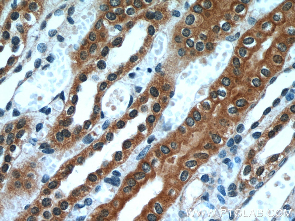 Immunohistochemistry (IHC) staining of human kidney tissue using PLS1 Polyclonal antibody (55212-1-AP)