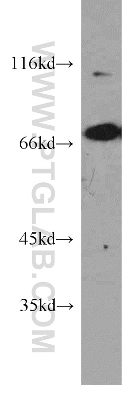 Western Blot (WB) analysis of COLO 320 cells using PLS1 Polyclonal antibody (55212-1-AP)