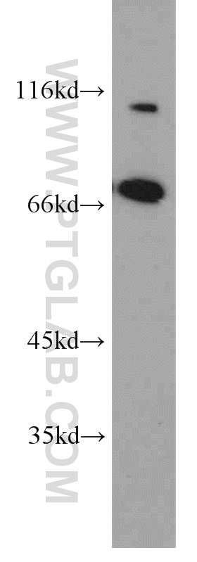 Western Blot (WB) analysis of COLO 320 cells using PLS1 Polyclonal antibody (55212-1-AP)