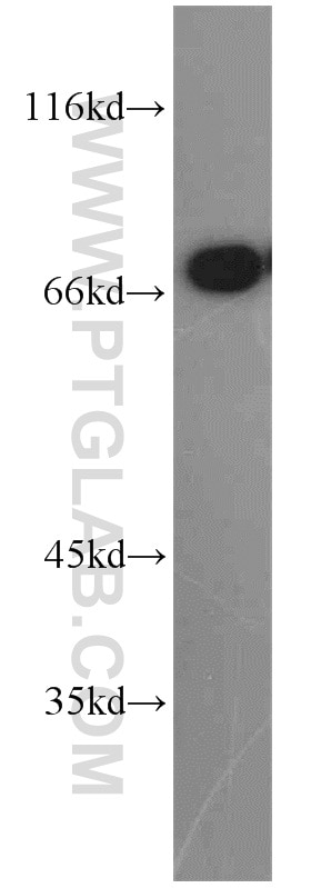 Western Blot (WB) analysis of mouse small intestine tissue using PLS1 Polyclonal antibody (55212-1-AP)