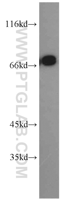 Western Blot (WB) analysis of mouse small intestine tissue using PLS1 Polyclonal antibody (55212-1-AP)