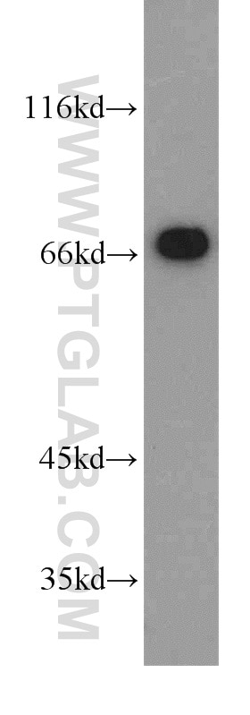 Western Blot (WB) analysis of COLO 320 cells using PLS1 Polyclonal antibody (55212-1-AP)