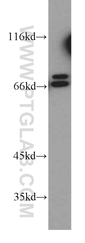 Western Blot (WB) analysis of COLO 320 cells using PLS1 Polyclonal antibody (55212-1-AP)